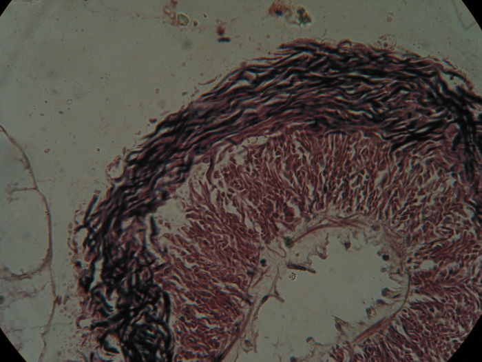 Holotype. transverse section, rhynchocoel wall