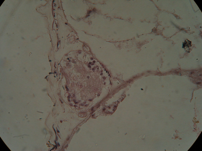 Holotype, transverse section, lateral nerve cord Holotype, transverse section, lateral nerve cord