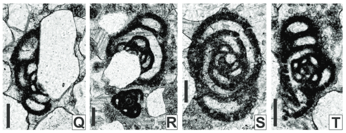 Calcitornella interpsammica Vachard, Krainer & Lucas in Lucas et al., 2016 Calcitornella interpsammica Vachard, Krainer & Lucas in Lucas et al., 2016