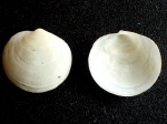 Anodontia edentula