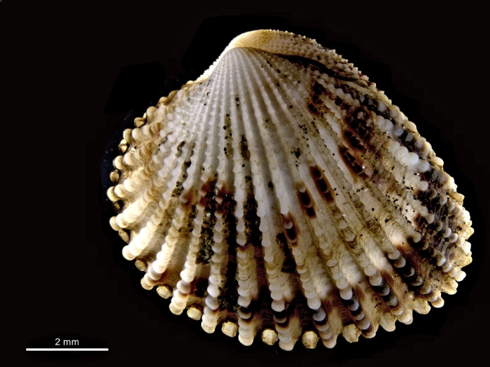 Cardiocardita lacunosa Cardiocardita lacunosa