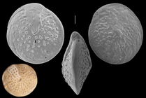 Amphistegina papillosa