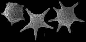 Baculogypsina sphaerulata