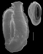 Edentostomina cultrata