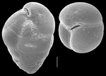 Eggerella bradyi