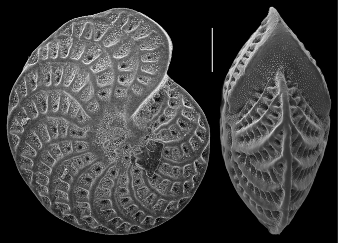 Elphidium owenianum (d'Orbigny 1839) New Caledonia