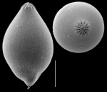 Glandulina suezensis