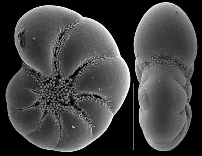 Haynesina depressula Haynesina depressula