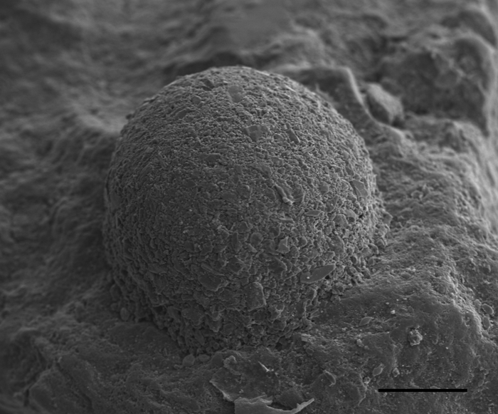 Hemisphaerammina bradyi Hemisphaerammina bradyi