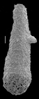 Hyperammina spiculifera