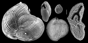 Miliolinella webbiana