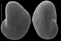 Nonion grossepertusum