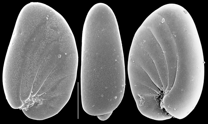 Nonionoides turgidum