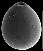 Parafissurina aventricosa