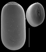 Parafissurina minuta