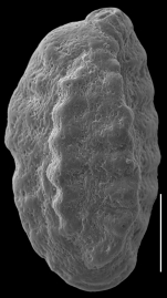 Pseudohauerinella diissidens