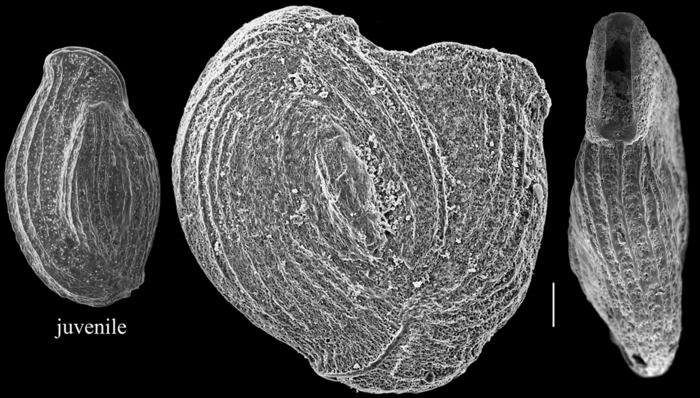Pseudomassilina macilenta