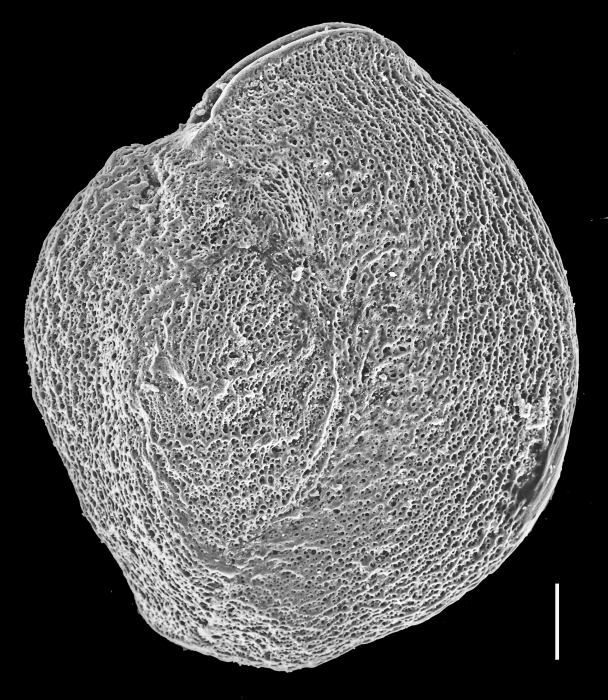 Pseudomassilina robusta