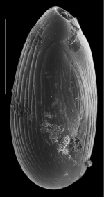 Quinqueloculina jugosa