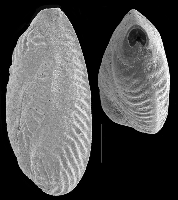 Quinqueloculina transversestriata
