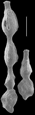 Rectomassilina tricarinata