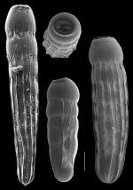 Siphogenerina raphana