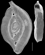 Spiroloculina acescata