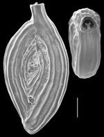 Spiroloculina antillarum