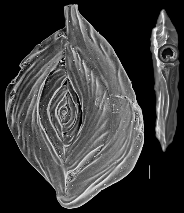 Spiroloculina samoaensis