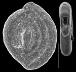 Spirosigmoilina parri