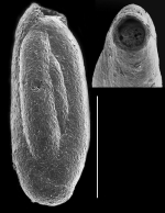 Trilocularena patensis