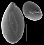 Triloculinella chiastocytis