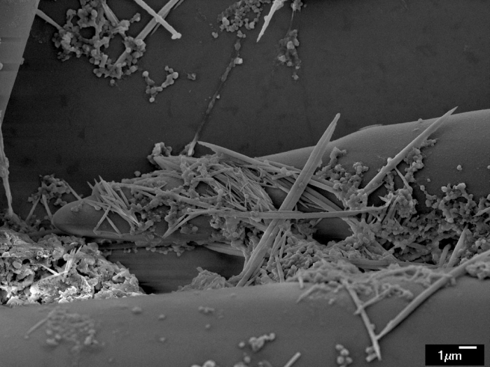 Axinella pyramidata - spicules Axinella pyramidata - spicules
