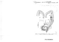 Polydesmus microcomplanatus