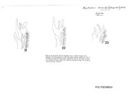 Xystocheir dissecta