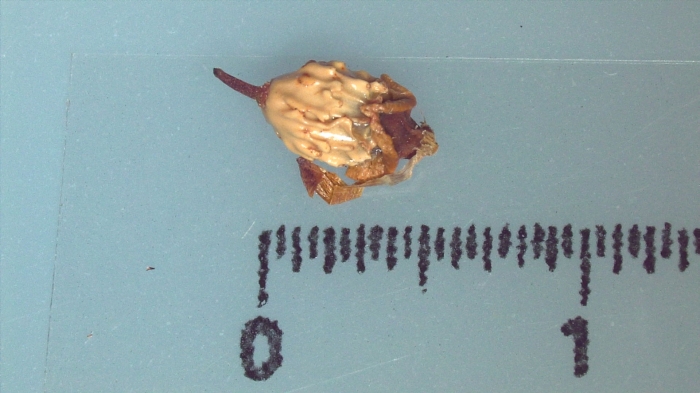 Nutlet of Scleria verrucosa K002786160 1 Nutlet of Scleria verrucosa K002786160 1