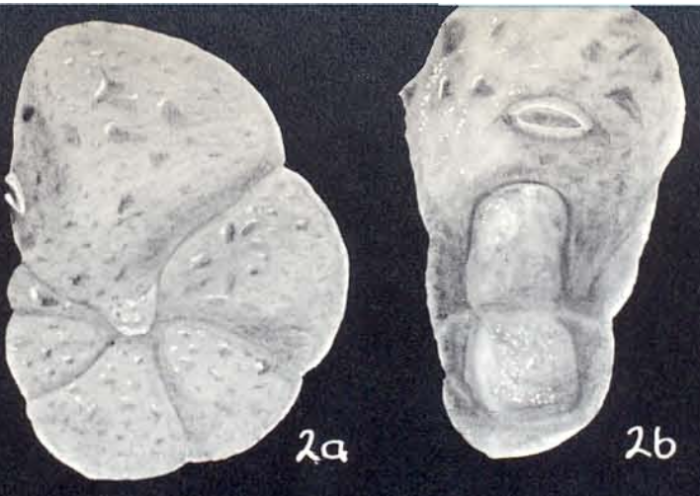 Alveolophragmium diversum McCulloch, 1981