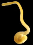 Nemertea (ribbon worms)