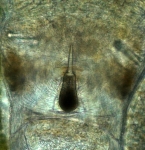 Stylet apparatus 