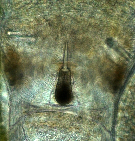 Stylet apparatus 
