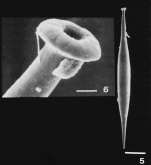 Hyalinonetrion sahulense Patterson & Richardson, 1988