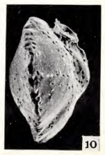 Siphonina georgiana Haynes, 1973