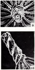 Lagena sulcata var. torquiformis Haynes, 1973