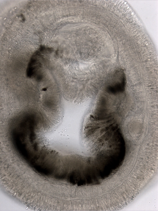 Unstained section of the gut with black pigment Unstained section of the gut with black pigment