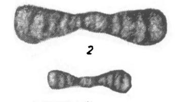 Ammodiscus diadema var. umbonata Potievskaya, 1958