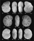 Elphidium balticum Knudsen, Schweizer & Seidenkrantz, 2025
