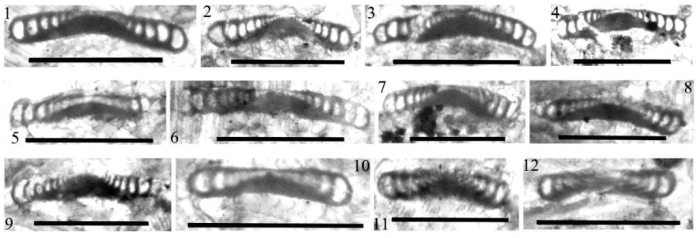 Monotaxinoides? melanogaster Yarahmadzahi &amp; Vachard, 2019