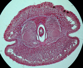 Transverse section (brain region)