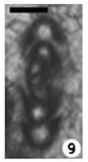 Asselodiscus davydovi Vachard &amp; Moix, 2011