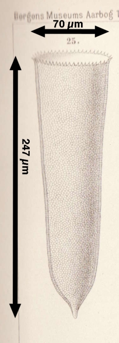 Parafavella dilatata was originally described as Cyttarocylis denticulata var. subrotundata f. dilatata